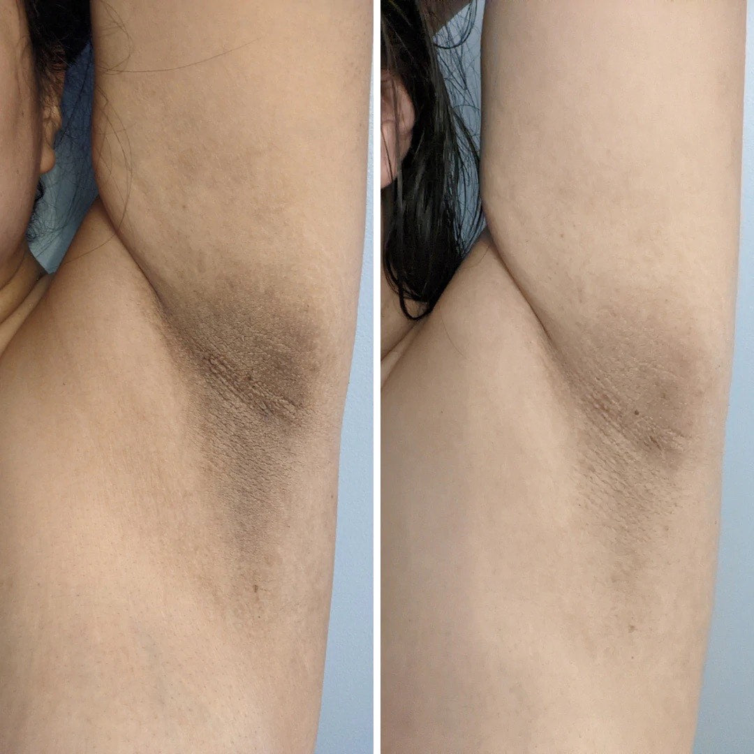 Intimate Lightening Cream 3 Pack