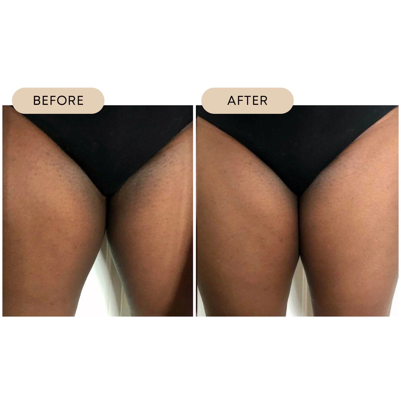 Intimate Lightening Cream 3 Pack